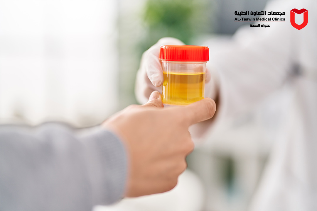 حرقان في البول | طرق العلاج المجربة ومتى يجب زيارة الطبيب؟