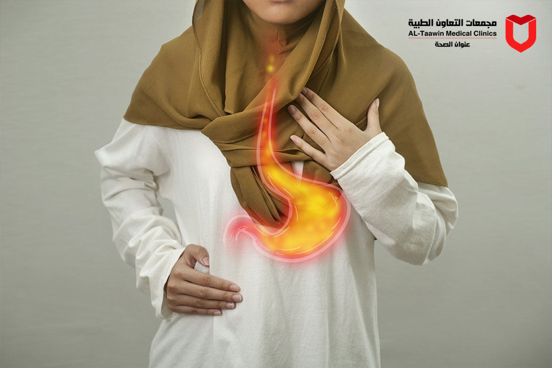 قرحة المعدة  أسبابها، أعراضها، وكيفية التخلص من آلامها