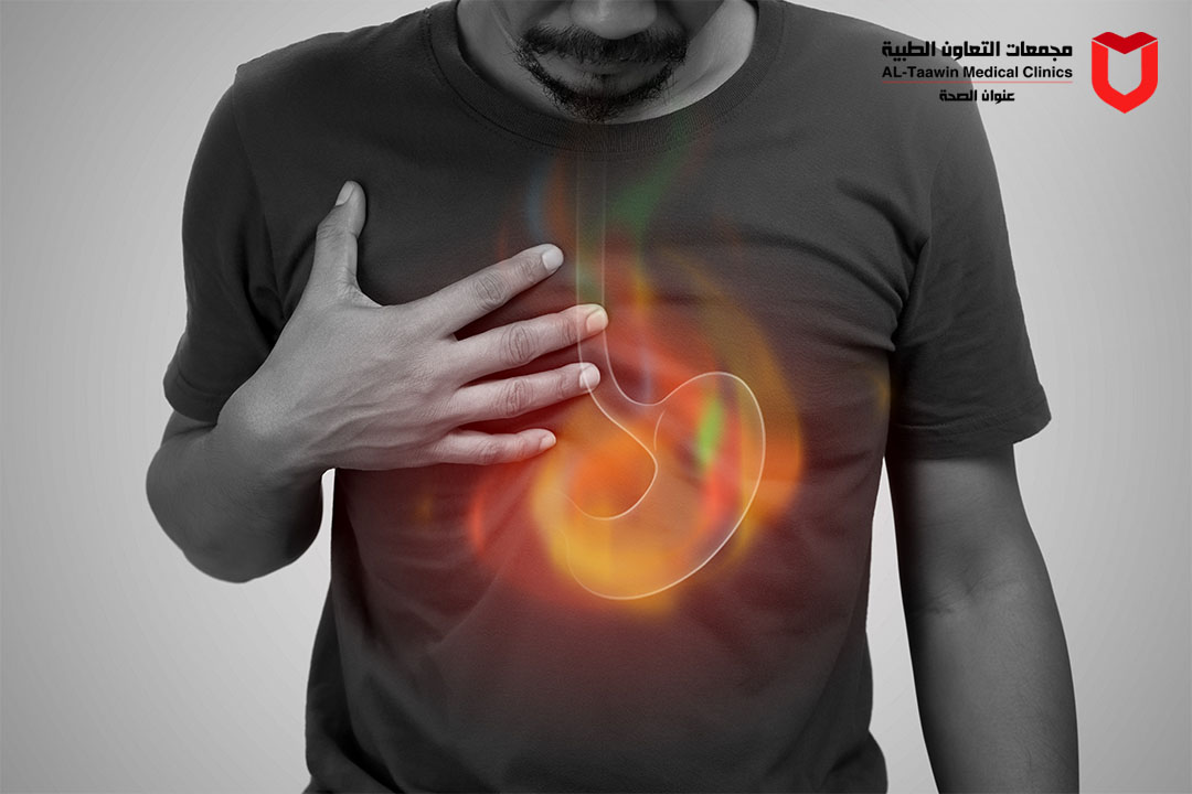 ارتجاع المريء | الأعراض والأسباب وطرق العلاج