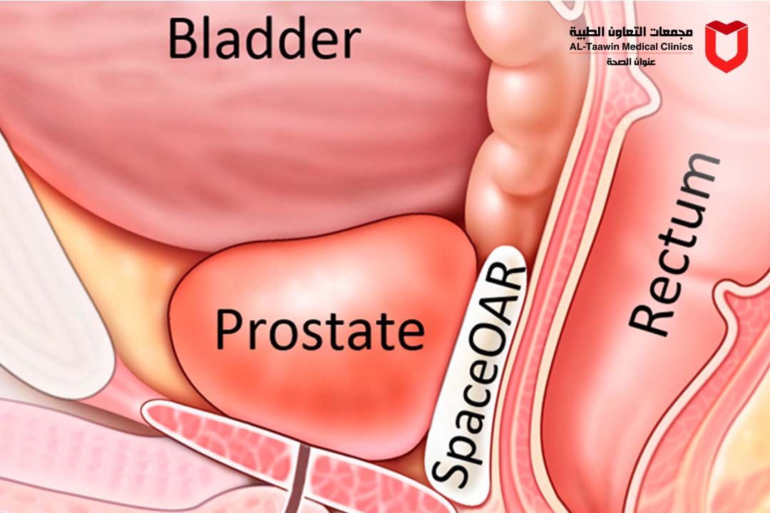 بروستات الرجال | الأعراض والأسباب وطرق العلاج