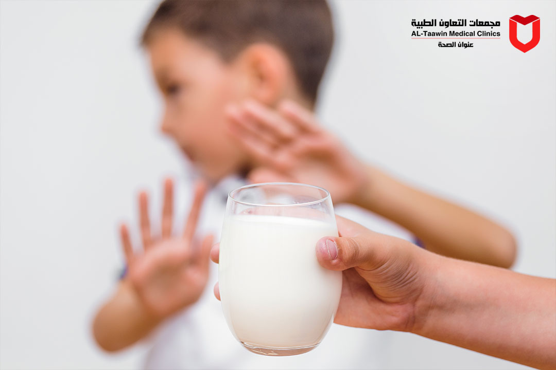حساسية الحليب لدى الاطفال | كيف تعرفها وما الحل للتخفيف من أعراضها؟