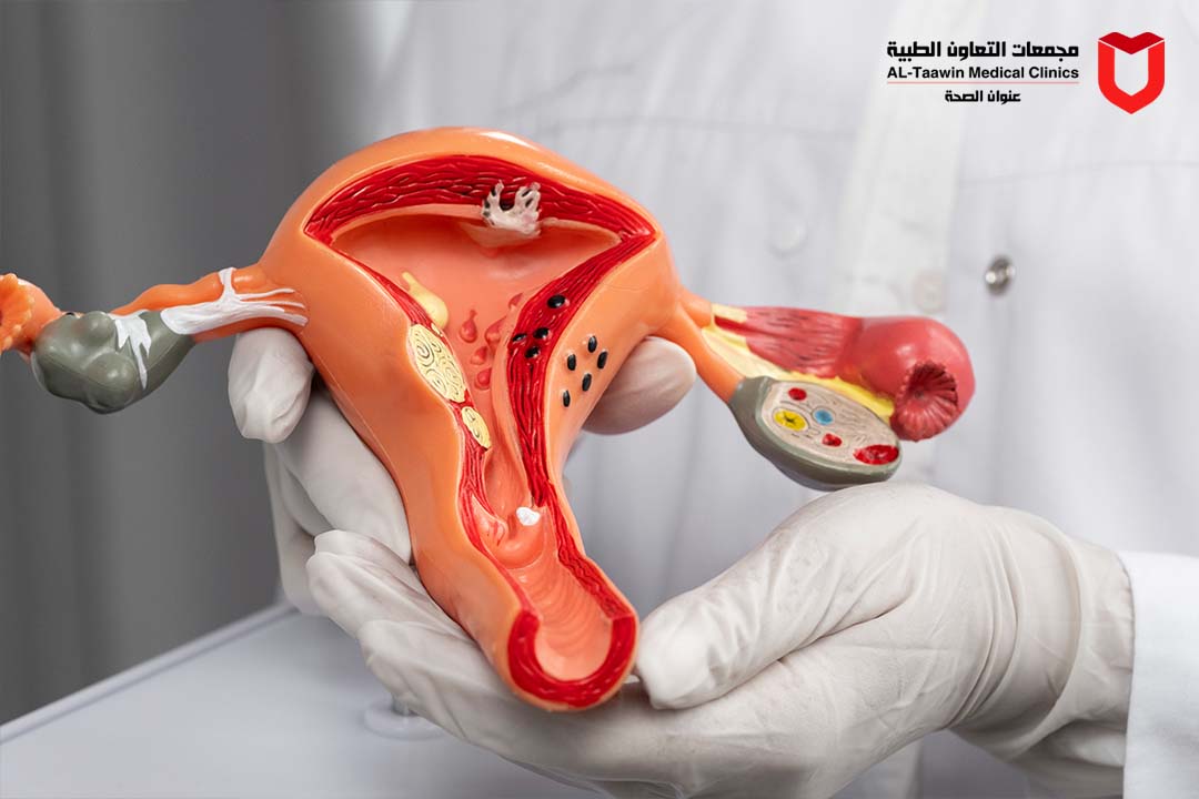 جراحات الرحم بالمنظار وبدون ألم | أحدث الحلول العلاجية