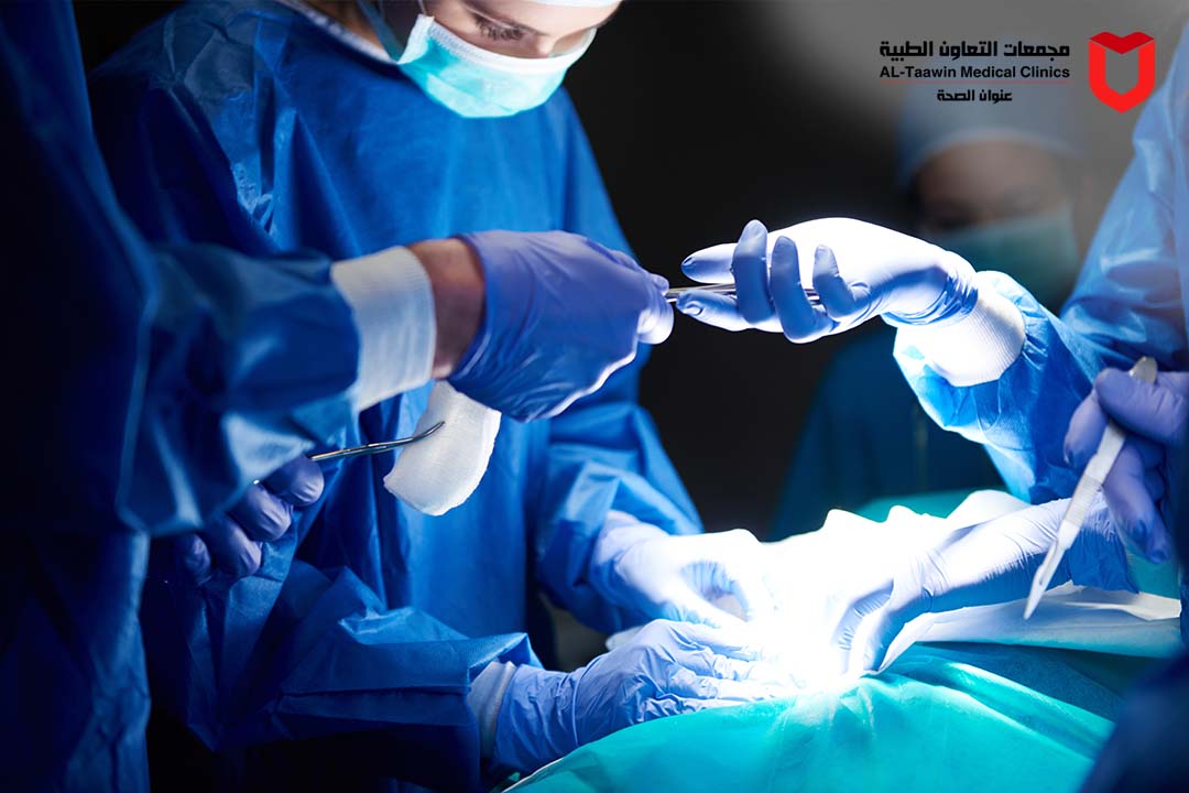 تحويل المسار المصغر | الفوائد والنتائج وأهم المعلومات