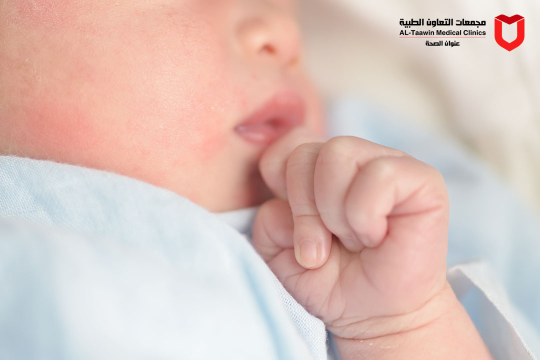 صفراء حديثى الولادة | الأسباب والأعراض وأحدث طرق العلاج