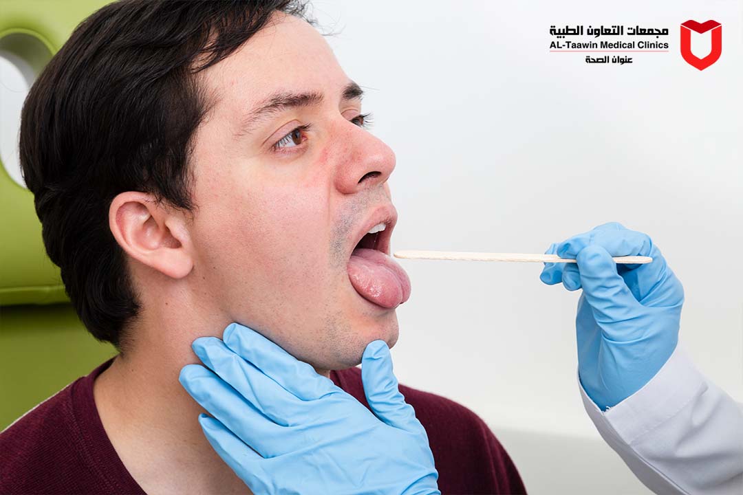 عملية اللوز | متى تحتاج إلى استئصال اللوزتين وكيف تتم العملية؟