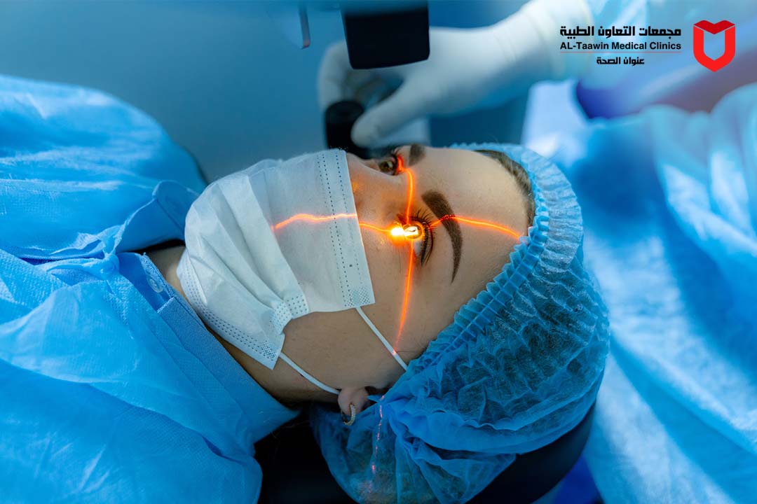 دليل عمليه ليزر العيون | الأسباب، الخطوات، والنصائح بعد العملية