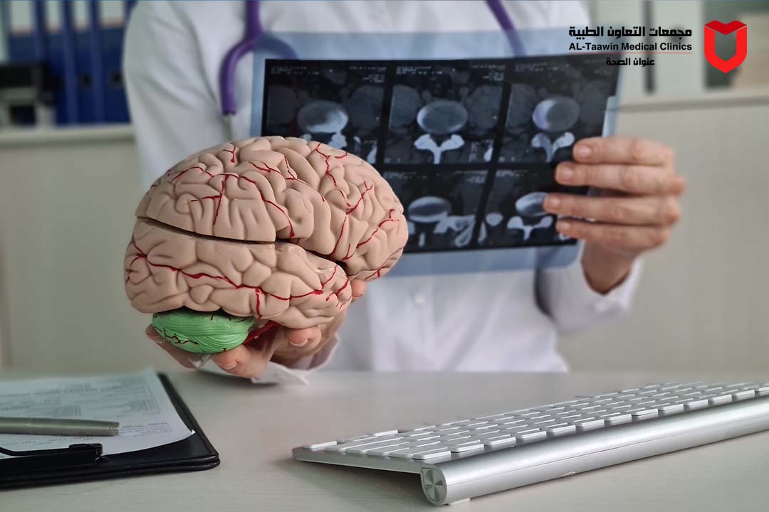 التصلب اللويحي | الأسباب، الأعراض، وأحدث طرق العلاج