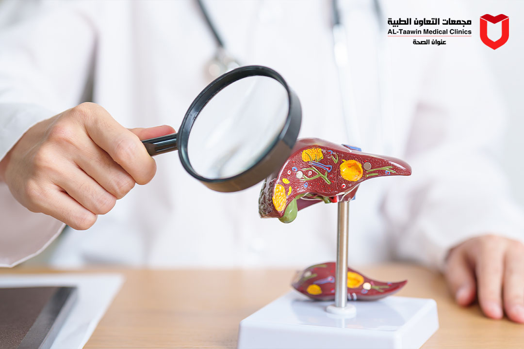 أسباب دهون الكبد وأعراضها | طرق التشخيص والعلاج الحديثة